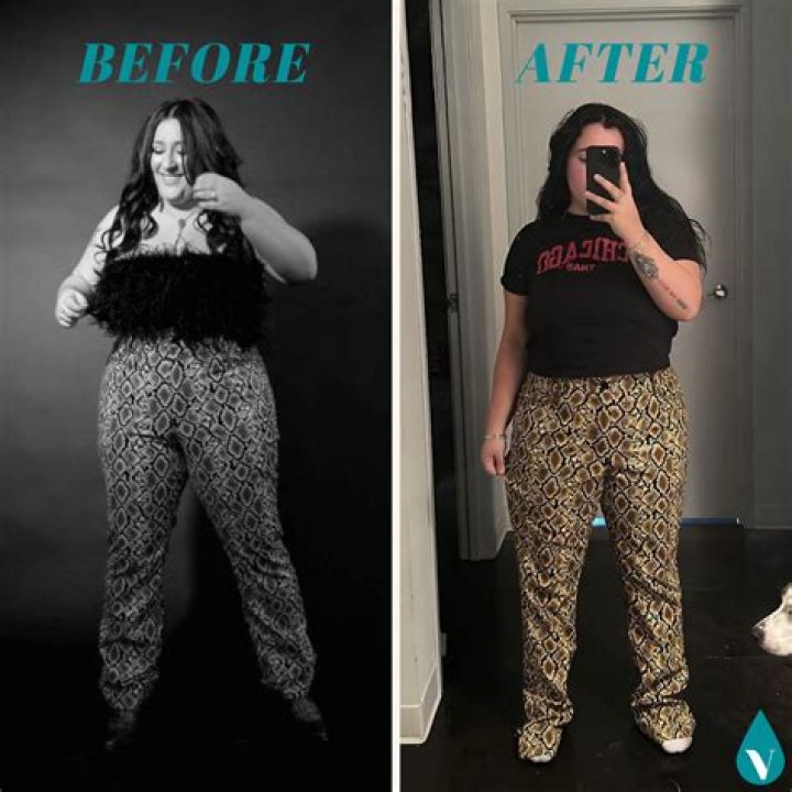 Brooke Schofield Weight Loss Before And After: What Happened To Her?