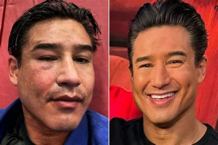 Did Mario Lopez Have Plastic Surgery? Courtney Mazza Husband Before & After