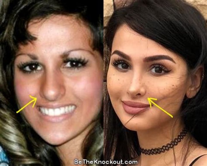 Photos: Had Sssniperwolf Has Plastic Surgery – Her Transformation Before & After